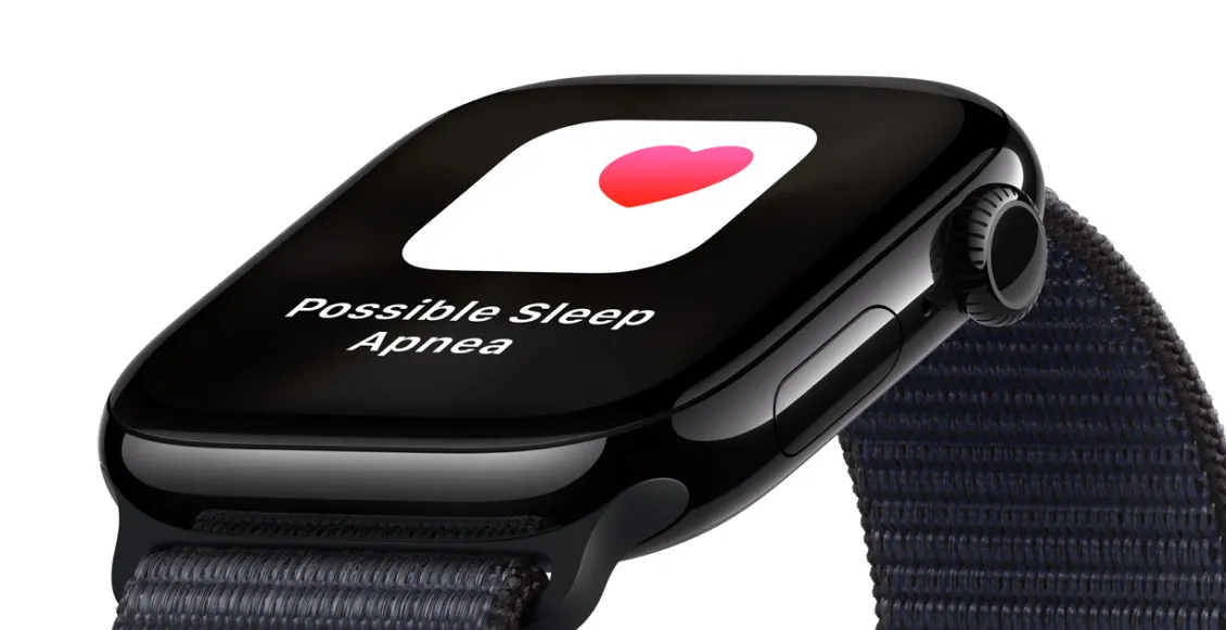 Apple Watch 10 5.webp